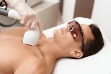 Laser Hair Removal VS Shaving